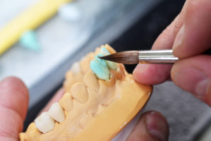 dental technician